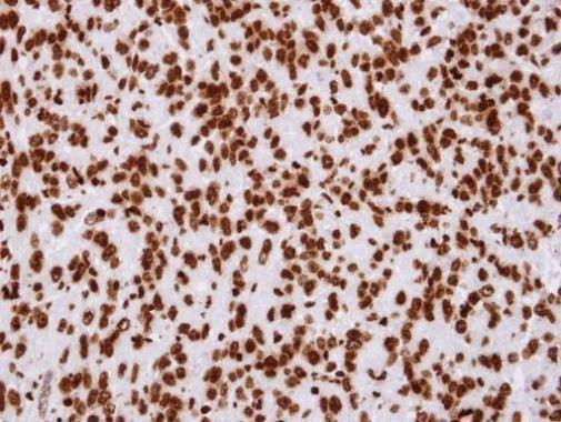 Anti-Histone H2A.Z Antibody