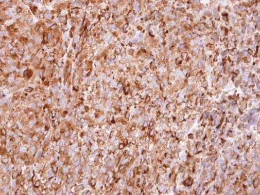 Anti-interferon alpha 2 Antibody