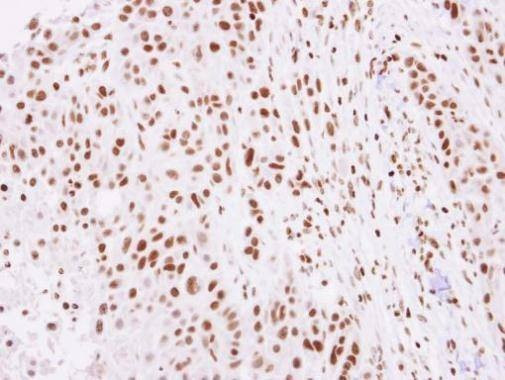 Anti-Histone H2A.Z Antibody