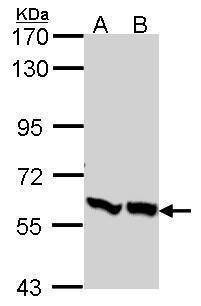 Anti-PFKFB3 (C-term) Antibody