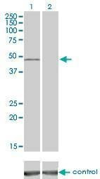 Anti-VRK1 Antibody