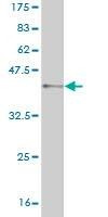 Anti-VRK1 Antibody