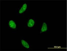 Anti-VRK1 Antibody