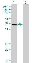 Anti-VRK1 Antibody