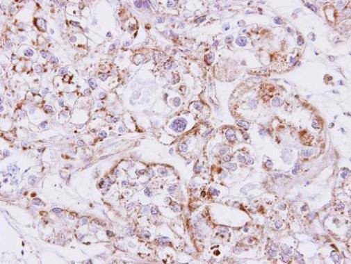 Anti-Inhibin beta A Antibody