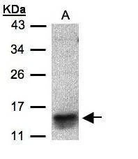 Anti-I-309 Antibody
