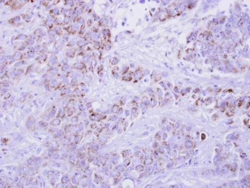Anti-I-309 Antibody
