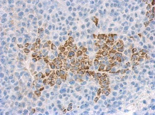 Anti-IL1F9 Antibody