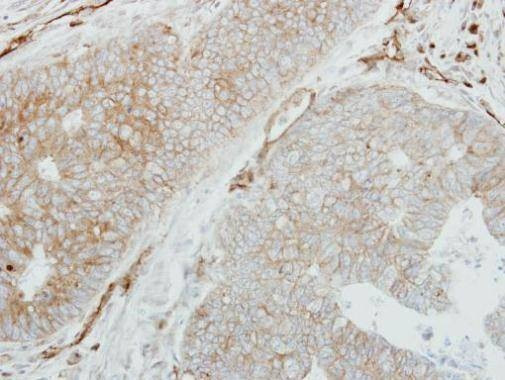 Anti-HLA-DMB (C-term) Antibody