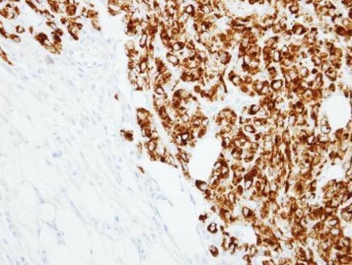 Anti-RANKL (C-term) Antibody