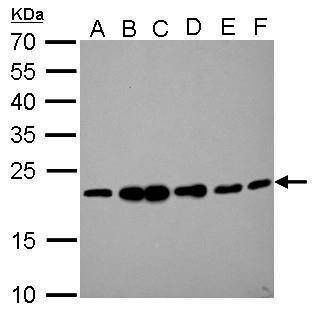 Anti-RAMP2 Antibody