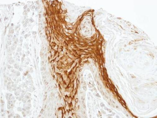 Anti-RAMP2 Antibody