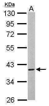 Anti-CaMK1D Antibody