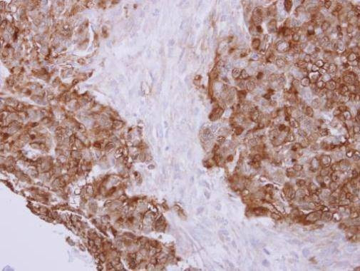 Anti-Profilin 2 Antibody