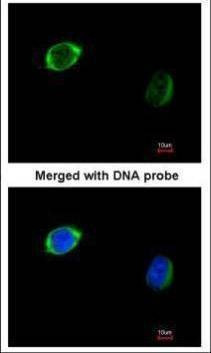 Anti-RAB2B Antibody