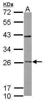 Anti-RAB3C Antibody