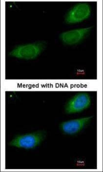 Anti-Fibrinogen gamma Antibody