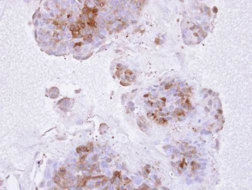 Anti-IL1 Receptor 2 Antibody