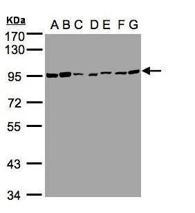 Anti-CD66e Antibody