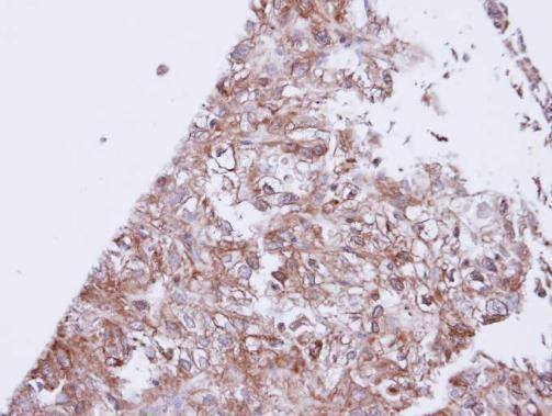 Anti-GIRK1 Antibody