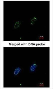 Anti-RPA70 Antibody