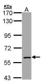 Anti-MTGR1 Antibody