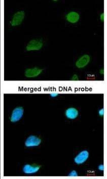 Anti-MTGR1 Antibody