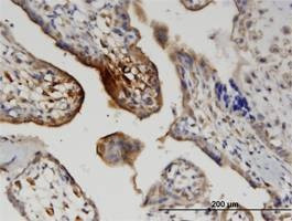 Anti-WNT5A Antibody