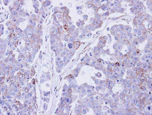 Anti-Desmocollin 2 (internal) Antibody