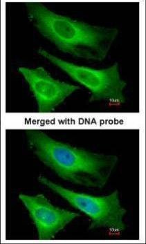 Anti-TNNI3K (internal) Antibody