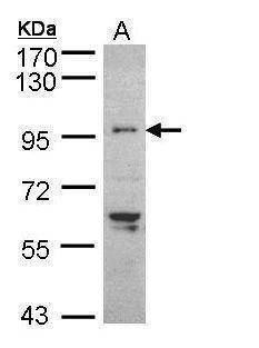 Anti-TNNI3K (internal) Antibody