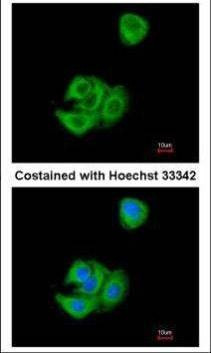 Anti-AGR3 Antibody