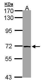 Anti-SLC25A13 (internal) Antibody
