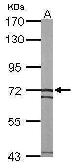 Anti-SLC25A13 (internal) Antibody