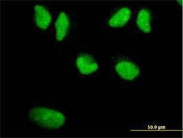 Anti-WRN Antibody