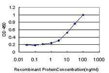 Anti-WRN Antibody