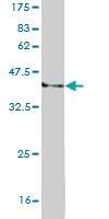 Anti-WRN Antibody