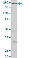 Anti-WRN Antibody