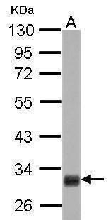 Anti-HMGCL Antibody