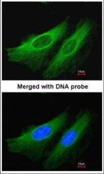 Anti-HMGCL Antibody