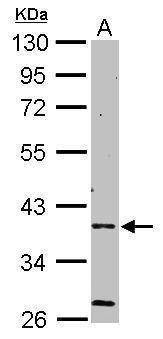 Anti-AMPK gamma 2 Antibody
