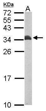 Anti-Beta ETF Antibody
