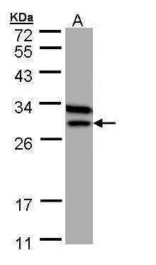 Anti-Beta ETF Antibody