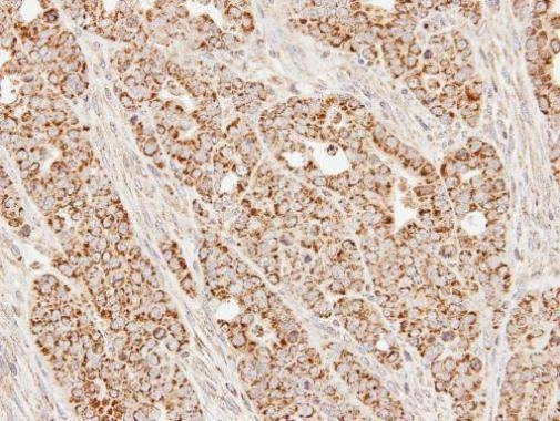 Anti-SUCLG1 Antibody