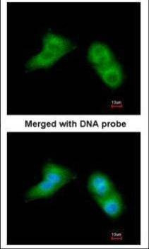 Anti-UBE2G2 Antibody