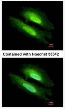 Anti-PDE6D Antibody
