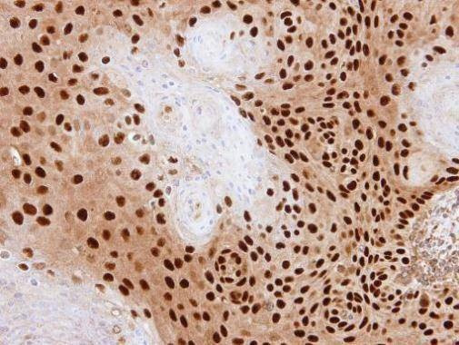 Anti-PDE6D Antibody