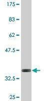 Anti-WTAP Antibody