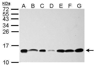 Anti-NHP2-like protein 1 Antibody