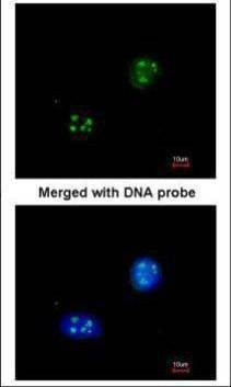 Anti-NHP2-like protein 1 Antibody